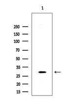 PP2A beta Antibody in Western Blot (WB)