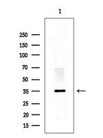 PP2A beta Antibody in Western Blot (WB)