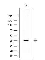 PP2A beta Antibody in Western Blot (WB)