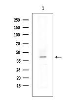 PP2A beta Antibody in Western Blot (WB)