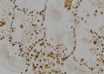 RAD23A Antibody in Immunohistochemistry (Paraffin) (IHC (P))