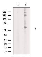 RAD23A Antibody in Western Blot (WB)