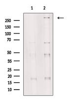 SETD2 Antibody in Western Blot (WB)