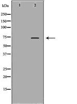 Plasma Kallikrein Antibody in Western Blot (WB)