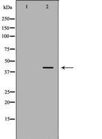 PKA beta Antibody in Western Blot (WB)