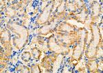 SLC4A4 Antibody in Immunohistochemistry (Paraffin) (IHC (P))