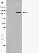 SLC4A4 Antibody in Western Blot (WB)