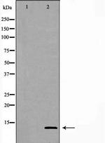 GHRH Antibody in Western Blot (WB)