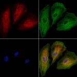 AP2A2 Antibody in Immunocytochemistry (ICC/IF)