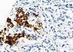 FBP1 Antibody in Immunohistochemistry (Paraffin) (IHC (P))