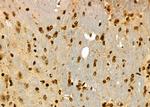 HEC1 Antibody in Immunohistochemistry (Paraffin) (IHC (P))