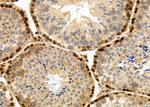 HEC1 Antibody in Immunohistochemistry (Paraffin) (IHC (P))