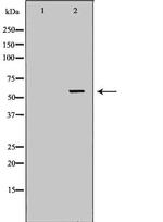 PCCB Antibody in Western Blot (WB)