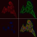 MTH1 Antibody in Immunocytochemistry (ICC/IF)