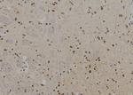 PFKM Antibody in Immunohistochemistry (Paraffin) (IHC (P))