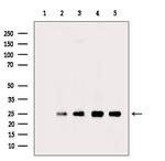 PSMB2 Antibody in Western Blot (WB)