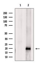 UBE2C Antibody in Western Blot (WB)