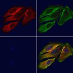 UGT1A4 Antibody in Immunocytochemistry (ICC/IF)