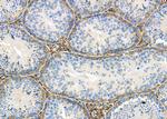 UGT1A4 Antibody in Immunohistochemistry (Paraffin) (IHC (P))