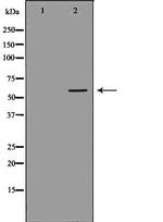 UGT1A4 Antibody in Western Blot (WB)