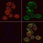 KLC1 Antibody in Immunocytochemistry (ICC/IF)