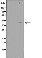 Asparagine Synthetase Antibody in Western Blot (WB)