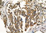 WNK3 Antibody in Immunohistochemistry (Paraffin) (IHC (P))