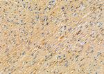 WNK3 Antibody in Immunohistochemistry (Paraffin) (IHC (P))