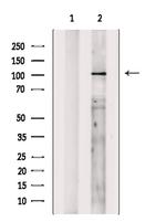 SKIV2L2 Antibody in Western Blot (WB)