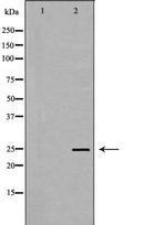 TK1 Antibody in Western Blot (WB)