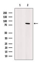 Artemis Antibody in Western Blot (WB)