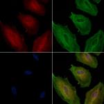 ECE1 Antibody in Immunocytochemistry (ICC/IF)