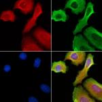 HEXA Antibody in Immunocytochemistry (ICC/IF)