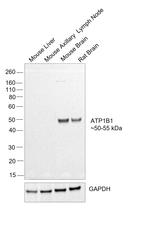 ATP1B1 Antibody