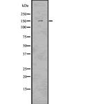 LATS2 Antibody in Western Blot (WB)