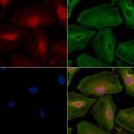 Phospho-nrf2 (Ser40) Antibody in Immunocytochemistry (ICC/IF)