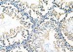 ASH2L Antibody in Immunohistochemistry (Paraffin) (IHC (P))