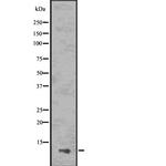 PYDC1 Antibody in Western Blot (WB)