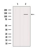 SMC3 Antibody in Western Blot (WB)