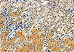 CSNK2B Antibody in Immunohistochemistry (Paraffin) (IHC (P))