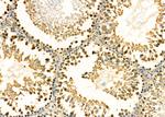 CSNK2B Antibody in Immunohistochemistry (Paraffin) (IHC (P))