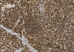 CSNK2B Antibody in Immunohistochemistry (Paraffin) (IHC (P))