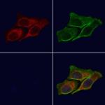 RAB10 Antibody in Immunocytochemistry (ICC/IF)