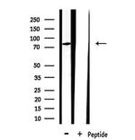 CLCN3 Antibody in Western Blot (WB)