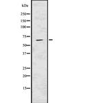 USP22 Antibody in Western Blot (WB)