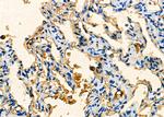 Synip Antibody in Immunohistochemistry (Paraffin) (IHC (P))