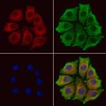 Synip Antibody in Immunocytochemistry (ICC/IF)