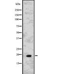 IL-15 Antibody in Western Blot (WB)