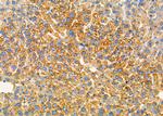 PRKD2 Antibody in Immunohistochemistry (Paraffin) (IHC (P))