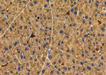 PRKD2 Antibody in Immunohistochemistry (Paraffin) (IHC (P))